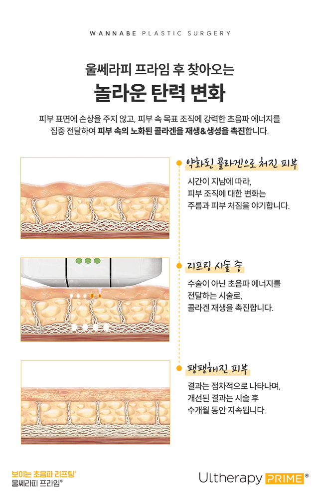 울쎄라피 프라임 후, 찾아오는 놀라운 변화 - 피부 표면에 손상을 주지 않고, 피부 속 목표 조직에 강력한 초음파 에너지를 집중 전달하여 피부 속의 노화된 콜라겐을 재생&생성을 촉진합니다.
